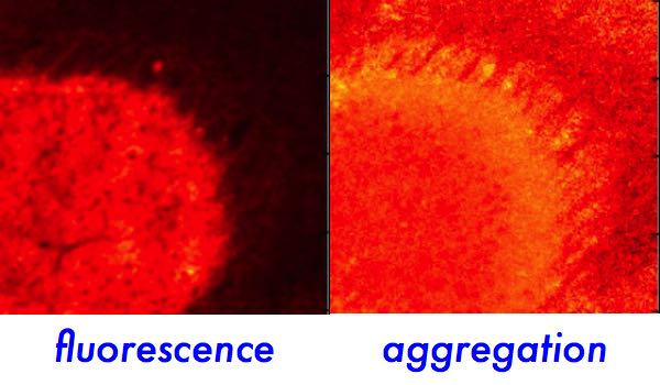 protein aggregation